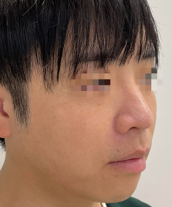 AFTER
