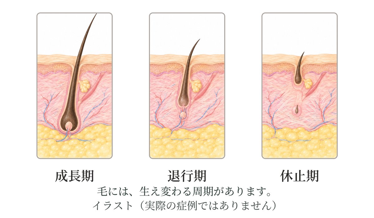 毛の生え変わる周期のイラスト。成長期・退行期・休止期の3つの時期の、毛と皮膚の断面