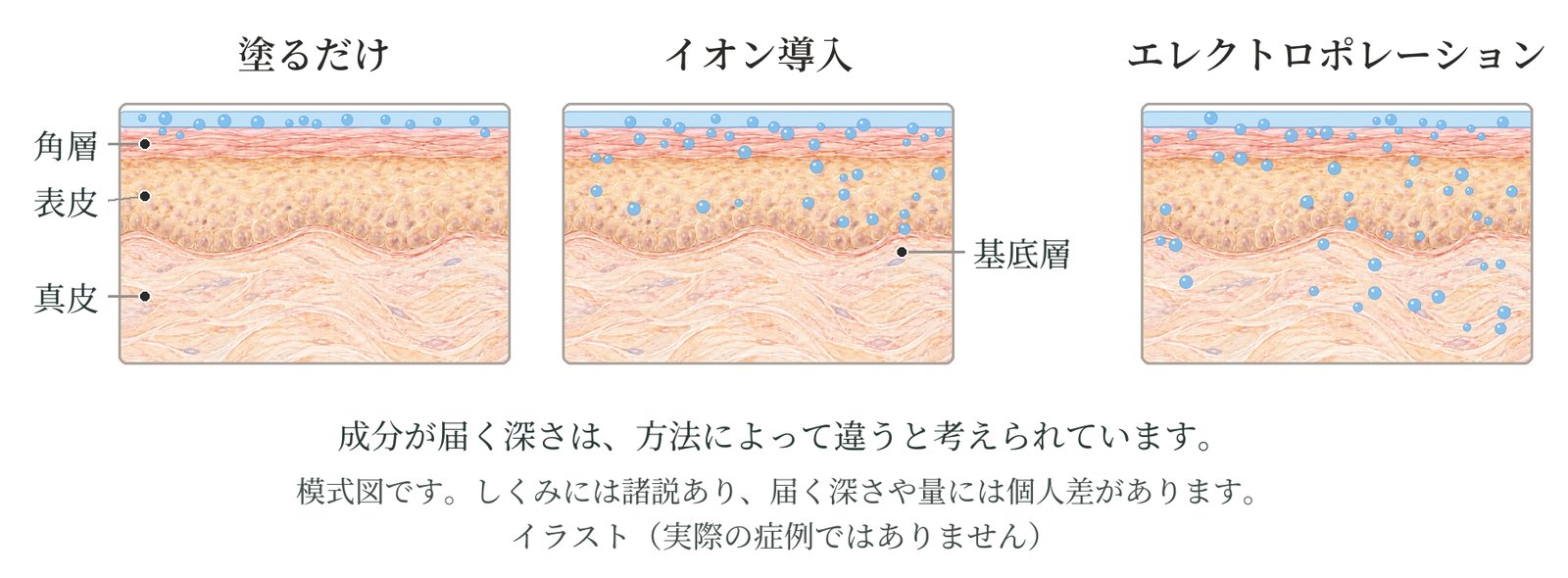 皮膚の断面の模式図。塗るだけ・イオン導入・エレクトロポレーションの3つ。塗るだけでは角層の上に、イオン導入は表皮の基底層まで、エレクトロポレーションは真皮まで成分が届くとされる