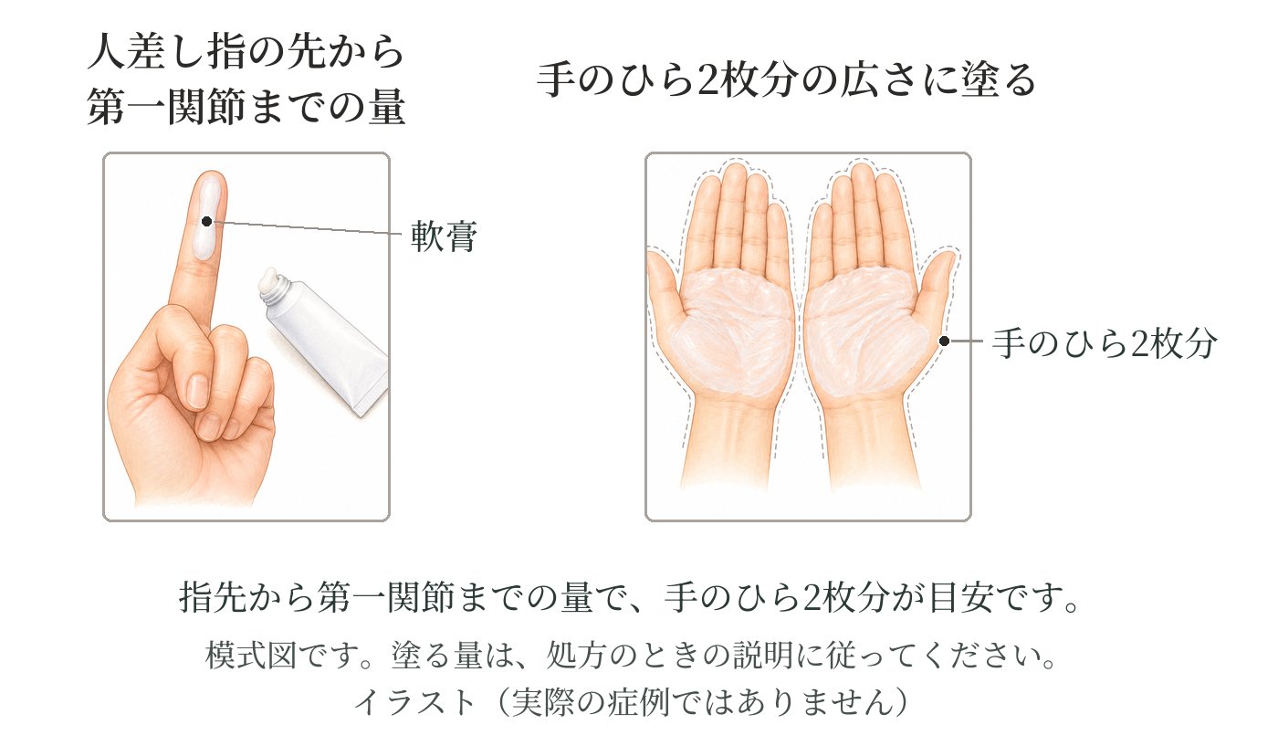 塗り薬の量の目安のイラスト。人差し指の先から第一関節までの量の軟膏を、手のひら2枚分の広さに塗る